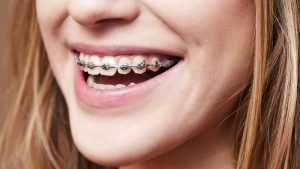Orthodontist in Beecroft