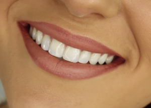 Orthodontics in Glenhaven