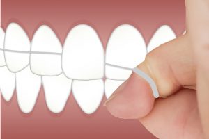 dental floss