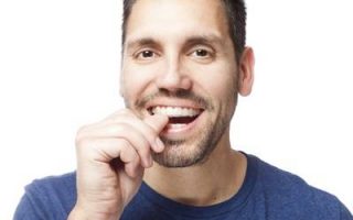 How long do I have to wear my retainers?