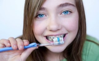 Looking after your teeth and gums during orthodontic treatment