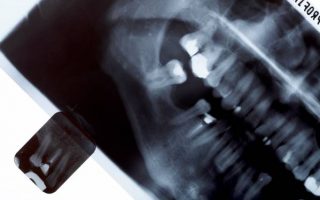 What to Expect From Your First Orthodontic Appointment