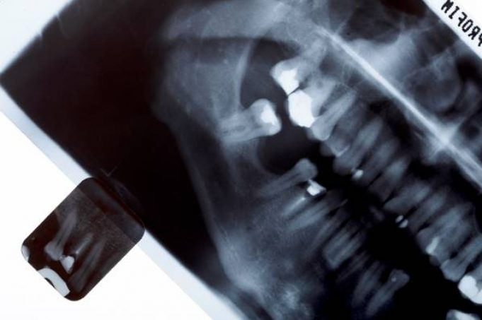 What to Expect From Your First Orthodontic Appointment
