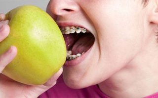 How will braces affect my child’s everyday routine?