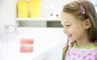 Braces terminology – what do all these words mean?