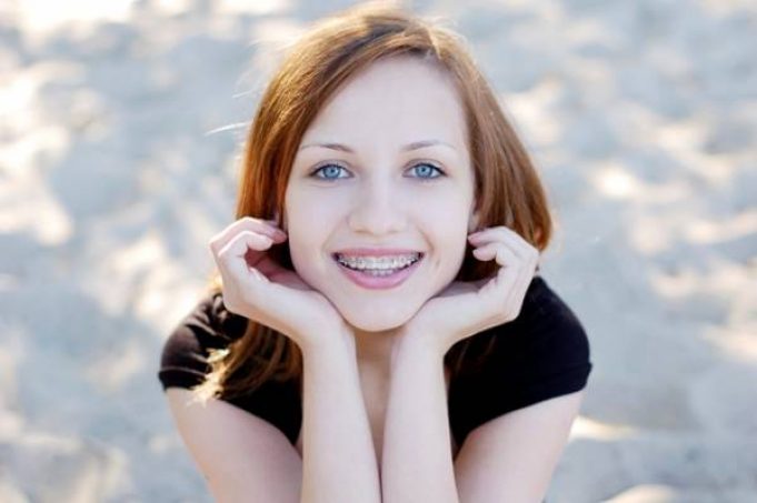 Are there any Side Effects to Wearing Braces?