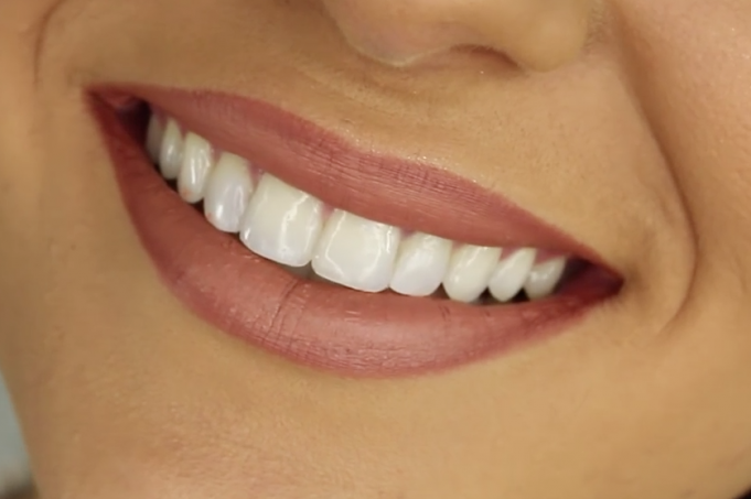 The history of orthodontics