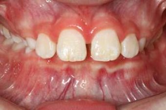 Orthodontist in Sydney
