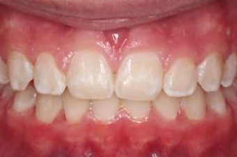 Orthodontist in Sydney
