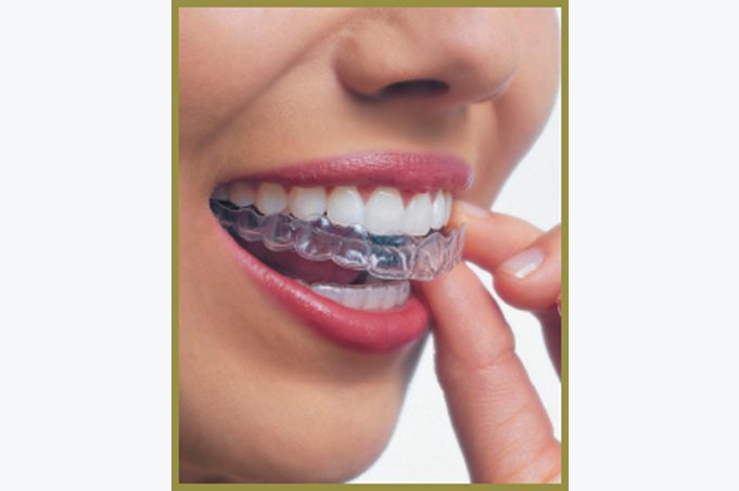 I want braces but I don’t want anyone to know!