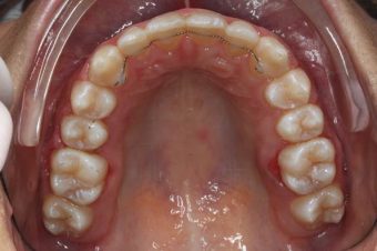 orthodontist in Sydney