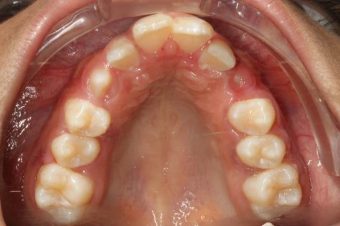 orthodontist in Sydney