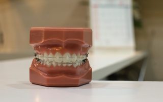 Working together – dentists and orthodontists