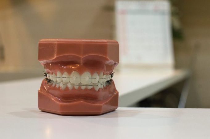Working together – dentists and orthodontists